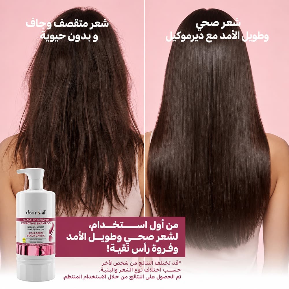 Collagen & Black Garlic Hair Growth Strengthening Shampoo