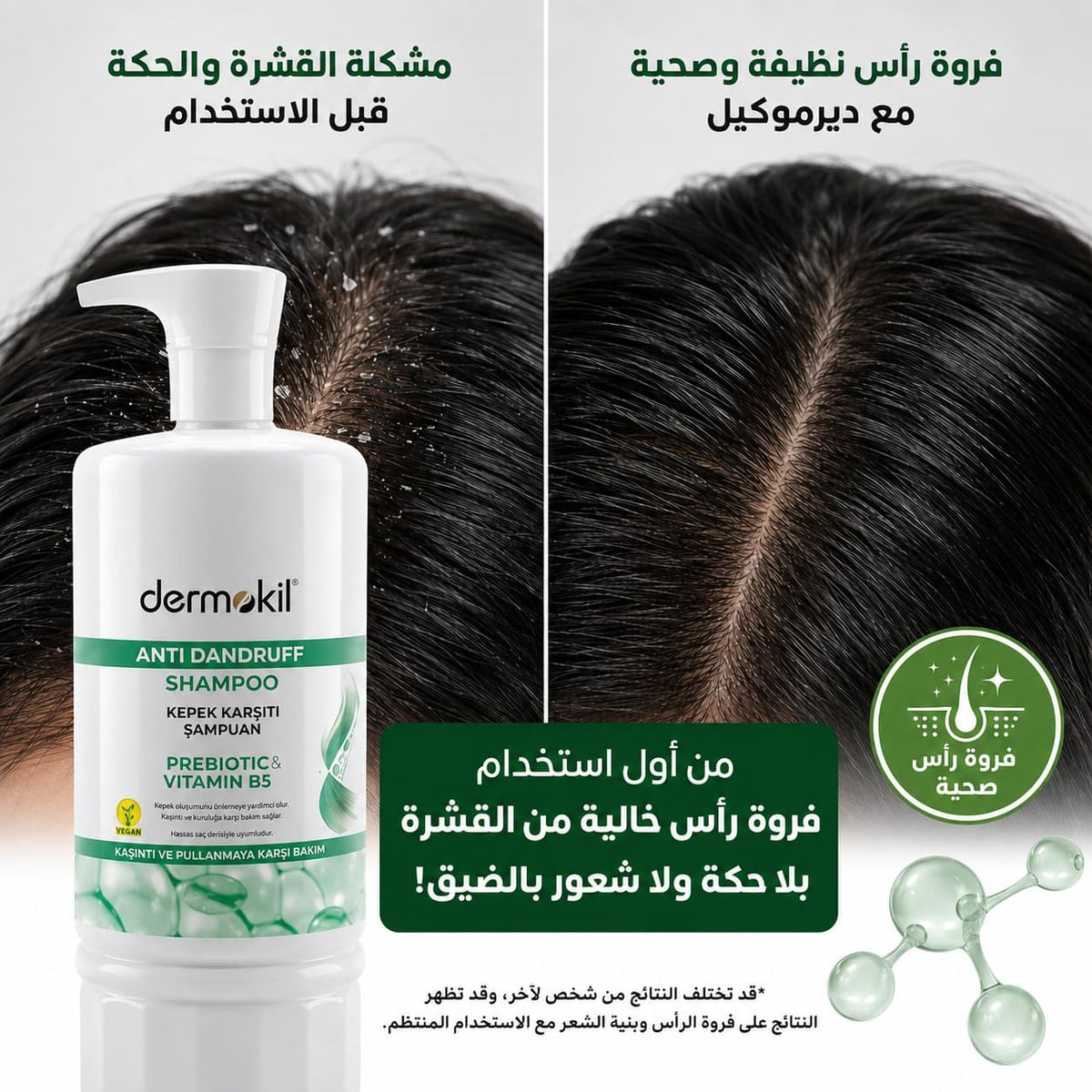 Prebiotic & Vitamin B5 Anti-Dandruff Scalp Care Shampoo